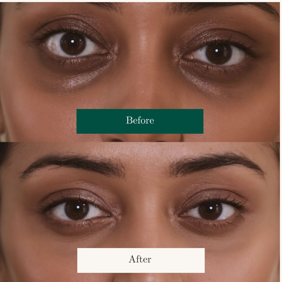Before After 0