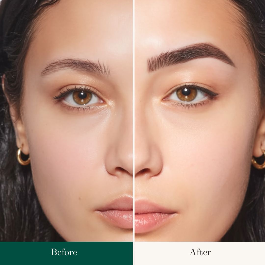 Before After 16